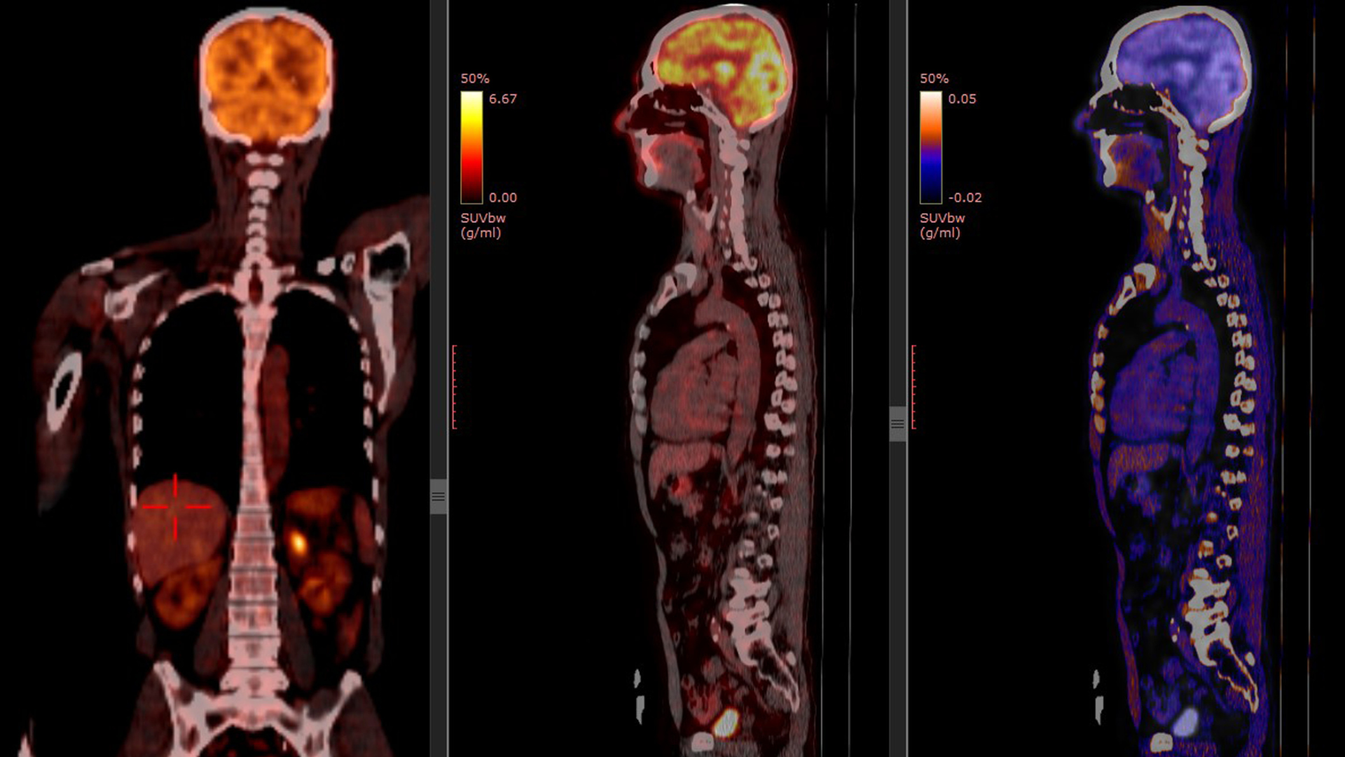 Médecine Nucléaire et Imagerie Oncologique Résultats d'examen 1920x1080